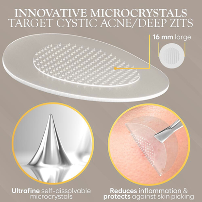 Hydrocolloid Micro-Dart Acne Patches – Clear Skin While You Sleep