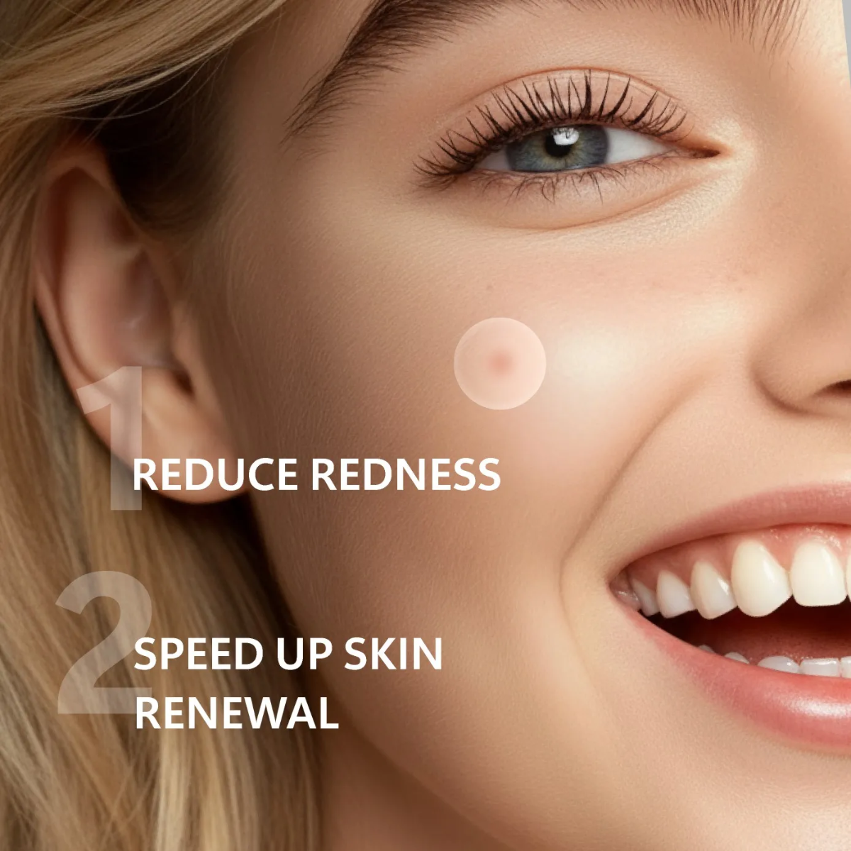 Hydrocolloid Micro-Dart Acne Patches – Clear Skin While You Sleep
